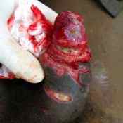 057 Large wound -a-.jpg
