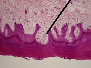 Meissner's corpuscle.jpg