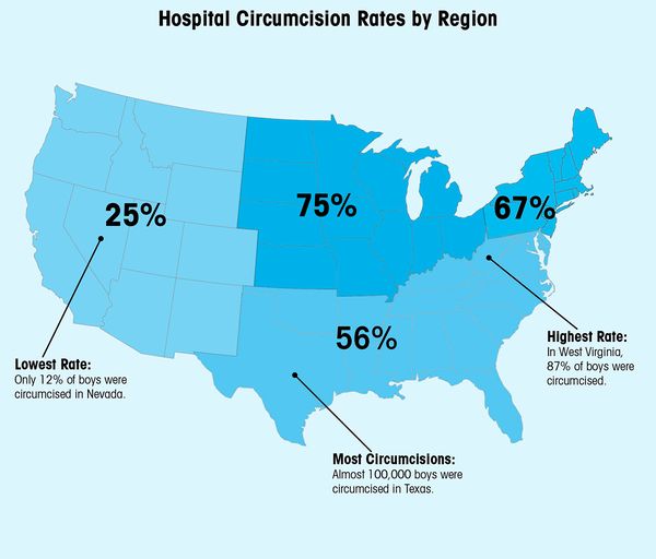 American circumcision rates by region.