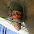 053 Large wound -a-.jpg