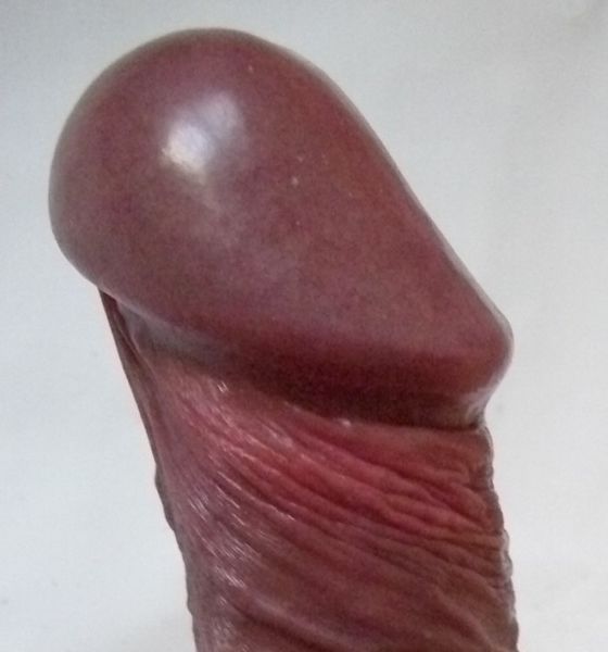 File:Glans side.jpg