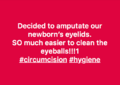 TR Amputating newborn's eyelids.png
